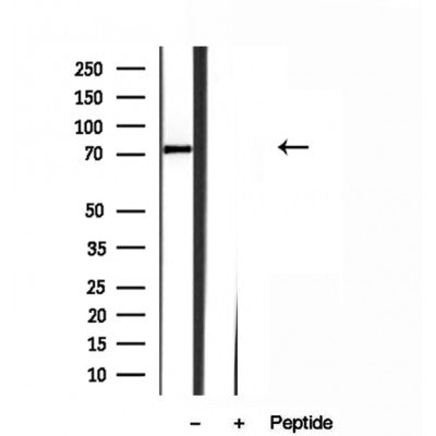 Western blot analysis of extracts from 3T3, using Kindlin 2 Antibody. The lane on the left was treated with blocking peptide.