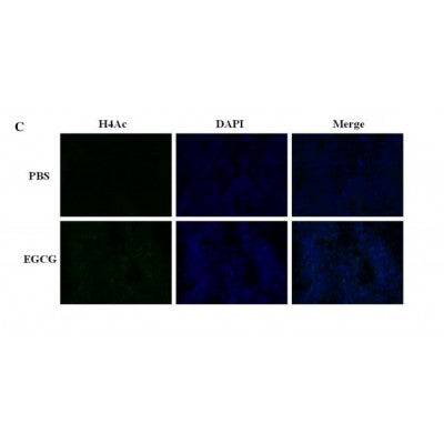 AF3355 staining Hela by IF/ICC. The sample were fixed with PFA and permeabilized in 0.1% Triton X-100,then blocked in 10% serum for 45 minutes at 25¡ãC. The primary antibody was diluted at 1/200 and incubated with the sample for 1 hour at 37¡ãC. An  Alexa Fluor 594 conjugated goat anti-rabbit IgG (H+L) Ab, diluted at 1/600, was used as the secondary antibod