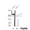 DF12081 at 1/100 staining Human brain cancer tissue by IHC-P. The sample was formaldehyde fixed and a heat mediated antigen retrieval step in citrate buffer was performed. The sample was then blocked and incubated with the antibody for 1.5 hours at 22¡ãC. An HRP conjugated goat anti-rabbit antibody was used as the secondary