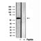Western blot analysis of extracts from various samples, using OXCT1 antibody.
 Lane 1: rat brain treated with blocking peptide.
 Lane 2: rat brain;
 Lane 3: 293;
 Lane 4: mouse spleen;
 Lane 5: hela;
 