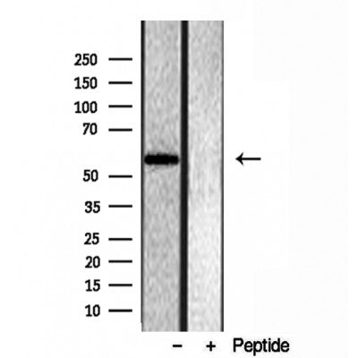 Western blot analysis of extracts from various samples, using OXCT1 antibody.
 Lane 1: rat brain treated with blocking peptide.
 Lane 2: rat brain;
 Lane 3: 293;
 Lane 4: mouse spleen;
 Lane 5: hela;
 
