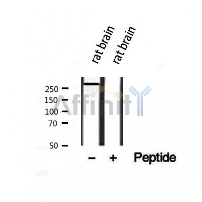 DF12083 at 1/100 staining Human brain cancer tissue by IHC-P. The sample was formaldehyde fixed and a heat mediated antigen retrieval step in citrate buffer was performed. The sample was then blocked and incubated with the antibody for 1.5 hours at 22¡ãC. An HRP conjugated goat anti-rabbit antibody was used as the secondary
