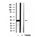 Western blot analysis of extracts from various samples, using RNASEH1 antibody.
 Lane 1: rat brain treated with blocking peptide.
 Lane 2: rat brain;
 Lane 3: 293;
 