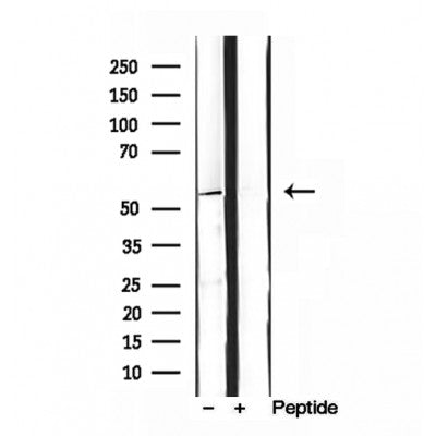 Western blot analysis of extracts from mouse spleen, using SKAP2 antibody. Lane 1 was treated with the blocking peptide.