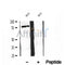 DF12086 at 1/100 staining Human breast cancer tissue by IHC-P. The sample was formaldehyde fixed and a heat mediated antigen retrieval step in citrate buffer was performed. The sample was then blocked and incubated with the antibody for 1.5 hours at 22¡ãC. An HRP conjugated goat anti-rabbit antibody was used as the secondary