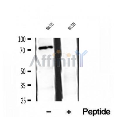 DF12086 at 1/100 staining Human breast cancer tissue by IHC-P. The sample was formaldehyde fixed and a heat mediated antigen retrieval step in citrate buffer was performed. The sample was then blocked and incubated with the antibody for 1.5 hours at 22¡ãC. An HRP conjugated goat anti-rabbit antibody was used as the secondary