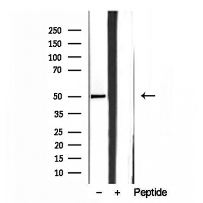 Western blot analysis of extracts from hela, using SQRDL antibody. Lane 1 was treated with the blocking peptide.