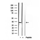 Western blot analysis of extracts from rat brain, using SULT4A1 antibody. Lane 1 was treated with the blocking peptide.