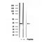 Western blot analysis of extracts from rat brain, using SULT4A1 antibody. Lane 1 was treated with the blocking peptide.