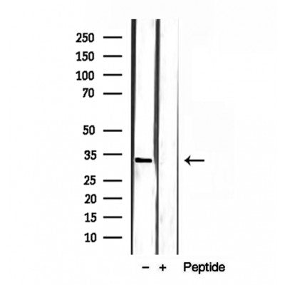Western blot analysis of extracts from rat brain, using SULT4A1 antibody. Lane 1 was treated with the blocking peptide.