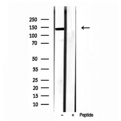 Western blot analysis of extracts from Mouse brain, using TET2 Antibody. Lane 1 was treated with the blocking peptide.