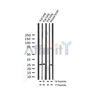 AF3356 staining NIH-3T3 by IF/ICC. The sample were fixed with PFA and permeabilized in 0.1% Triton X-100,then blocked in 10% serum for 45 minutes at 25¡ãC. The primary antibody was diluted at 1/200 and incubated with the sample for 1 hour at 37¡ãC. An  Alexa Fluor 594 conjugated goat anti-rabbit IgG (H+L) Ab, diluted at 1/600, was used as the secondary antibod