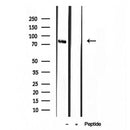 Western blot analysis of extracts from Mouse myeloma, using TMEM173/STING antibody. Lane 1 was treated with the blocking peptide.