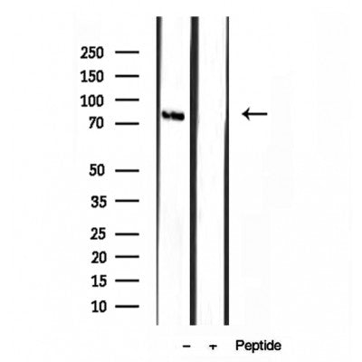 Western blot analysis of extracts from Mouse myeloma, using TMEM173/STING antibody. Lane 1 was treated with the blocking peptide.