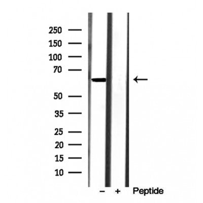 Western blot analysis of extracts from rat spleen, using AHCYL1 antibody. Lane 1 was treated with the blocking peptide.