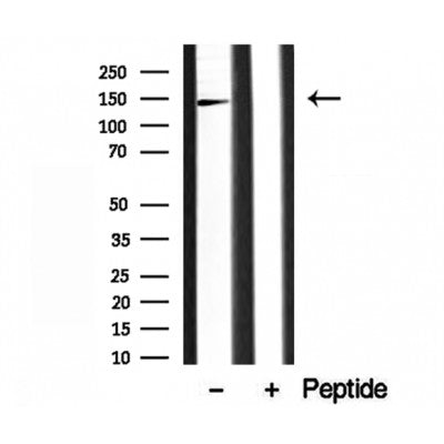 Western blot analysis of extracts from Hela, using AP3B1 Antibody. The lane on the left was treated with blocking peptide.