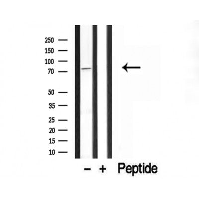Western blot analysis of extracts from Hela, using BBS2 Antibody. The lane on the left was treated with blocking peptide.