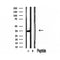 DF12099 staining HepG2 by IF/ICC. The sample were fixed with PFA and permeabilized in 0.1% Triton X-100,then blocked in 10% serum for 45 minutes at 25¡ãC. The primary antibody was diluted at 1/200 and incubated with the sample for 1 hour at 37¡ãC. An  Alexa Fluor 594 conjugated goat anti-rabbit IgG (H+L) Ab, diluted at 1/600, was used as the secondary antibod