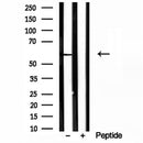 DF12100 staining HepG2 by IF/ICC. The sample were fixed with PFA and permeabilized in 0.1% Triton X-100,then blocked in 10% serum for 45 minutes at 25¡ãC. The primary antibody was diluted at 1/200 and incubated with the sample for 1 hour at 37¡ãC. An  Alexa Fluor 594 conjugated goat anti-rabbit IgG (H+L) Ab, diluted at 1/600, was used as the secondary antibod