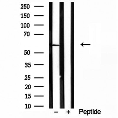 DF12100 staining HepG2 by IF/ICC. The sample were fixed with PFA and permeabilized in 0.1% Triton X-100,then blocked in 10% serum for 45 minutes at 25¡ãC. The primary antibody was diluted at 1/200 and incubated with the sample for 1 hour at 37¡ãC. An  Alexa Fluor 594 conjugated goat anti-rabbit IgG (H+L) Ab, diluted at 1/600, was used as the secondary antibod
