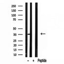 Western blot analysis of extracts from 293, using LDHB antibody. Lane 1 was treated with the blocking peptide.