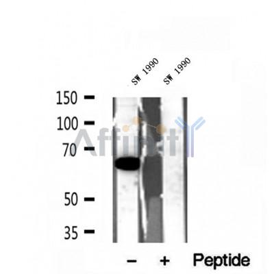 DF12104 at 1/100 staining mouse brain tissue by IHC-P. The sample was formaldehyde fixed and a heat mediated antigen retrieval step in citrate buffer was performed. The sample was then blocked and incubated with the antibody for 1.5 hours at 22¡ãC. An HRP conjugated goat anti-rabbit antibody was used as the secondary
