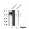 DF12105 at 1/100 staining Mouse muscle tissue by IHC-P. The sample was formaldehyde fixed and a heat mediated antigen retrieval step in citrate buffer was performed. The sample was then blocked and incubated with the antibody for 1.5 hours at 22¡ãC. An HRP conjugated goat anti-rabbit antibody was used as the secondary