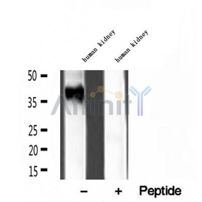 DF12105 at 1/100 staining Mouse muscle tissue by IHC-P. The sample was formaldehyde fixed and a heat mediated antigen retrieval step in citrate buffer was performed. The sample was then blocked and incubated with the antibody for 1.5 hours at 22¡ãC. An HRP conjugated goat anti-rabbit antibody was used as the secondary