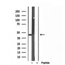 DF12106 staining HepG2 by IF/ICC. The sample were fixed with PFA and permeabilized in 0.1% Triton X-100,then blocked in 10% serum for 45 minutes at 25¡ãC. The primary antibody was diluted at 1/200 and incubated with the sample for 1 hour at 37¡ãC. An  Alexa Fluor 594 conjugated goat anti-rabbit IgG (H+L) Ab, diluted at 1/600, was used as the secondary antibod