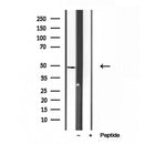 DF12107 staining HepG2 by IF/ICC. The sample were fixed with PFA and permeabilized in 0.1% Triton X-100,then blocked in 10% serum for 45 minutes at 25¡ãC. The primary antibody was diluted at 1/200 and incubated with the sample for 1 hour at 37¡ãC. An  Alexa Fluor 594 conjugated goat anti-rabbit IgG (H+L) Ab, diluted at 1/600, was used as the secondary antibod