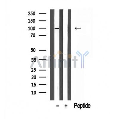 Western blot analysis of extracts from 293, using AGGF1 antibody. Lane 1 was treated with the blocking peptide.