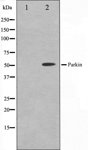 Western blot analysis on HeLa cell lysate using Parkin Antibody. The lane on the left is treated with the antigen-specific peptide.