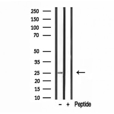 Western blot analysis of extracts from Hybridoma cells, using ALR Antibody. Lane 1 was treated with the blocking peptide.