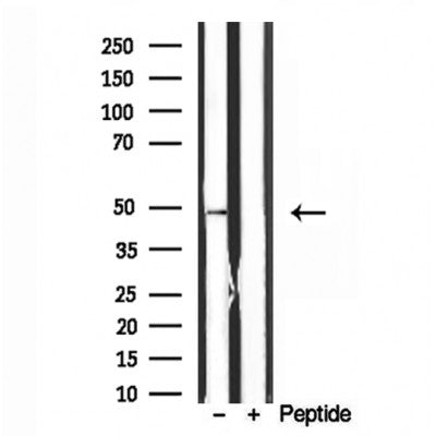 Western blot analysis of extracts from various samples, using ATPB antibody.
 Lane 1: HepG2 treated with blocking peptide.
 Lane 2: HepG2;
 Lane 3: 293;
 Lane 4: mouse brain;
 Lane 5: rat muscle;
 