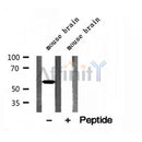 DF12113 at 1/100 staining Human prostate tissue by IHC-P. The sample was formaldehyde fixed and a heat mediated antigen retrieval step in citrate buffer was performed. The sample was then blocked and incubated with the antibody for 1.5 hours at 22¡ãC. An HRP conjugated goat anti-rabbit antibody was used as the secondary