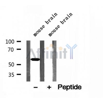 DF12113 at 1/100 staining Human prostate tissue by IHC-P. The sample was formaldehyde fixed and a heat mediated antigen retrieval step in citrate buffer was performed. The sample was then blocked and incubated with the antibody for 1.5 hours at 22¡ãC. An HRP conjugated goat anti-rabbit antibody was used as the secondary