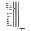 Western blot analysis of extracts from 293, using ERp72 antibody. Lane 1 was treated with the blocking peptide.