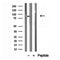 Western blot analysis of extracts from 293, using ERp72 antibody. Lane 1 was treated with the blocking peptide.