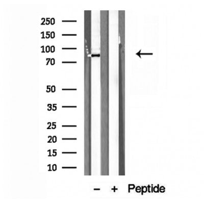 Western blot analysis of extracts from 293, using ERp72 antibody. Lane 1 was treated with the blocking peptide.