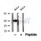DF12116 at 1/100 staining Mouse kidney tissue by IHC-P. The sample was formaldehyde fixed and a heat mediated antigen retrieval step in citrate buffer was performed. The sample was then blocked and incubated with the antibody for 1.5 hours at 22¡ãC. An HRP conjugated goat anti-rabbit antibody was used as the secondary