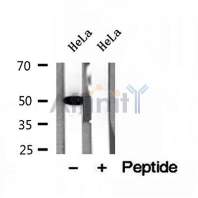 DF12116 at 1/100 staining Mouse kidney tissue by IHC-P. The sample was formaldehyde fixed and a heat mediated antigen retrieval step in citrate buffer was performed. The sample was then blocked and incubated with the antibody for 1.5 hours at 22¡ãC. An HRP conjugated goat anti-rabbit antibody was used as the secondary