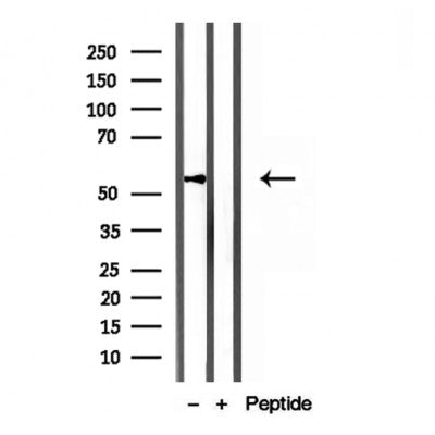 Western blot analysis of extracts from mouse brain, using KMO antibody. Lane 1 was treated with the blocking peptide.