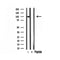 DF12119 staining HepG2 by IF/ICC. The sample were fixed with PFA and permeabilized in 0.1% Triton X-100,then blocked in 10% serum for 45 minutes at 25¡ãC. The primary antibody was diluted at 1/200 and incubated with the sample for 1 hour at 37¡ãC. An  Alexa Fluor 594 conjugated goat anti-rabbit IgG (H+L) Ab, diluted at 1/600, was used as the secondary antibod