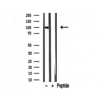 DF12119 staining HepG2 by IF/ICC. The sample were fixed with PFA and permeabilized in 0.1% Triton X-100,then blocked in 10% serum for 45 minutes at 25¡ãC. The primary antibody was diluted at 1/200 and incubated with the sample for 1 hour at 37¡ãC. An  Alexa Fluor 594 conjugated goat anti-rabbit IgG (H+L) Ab, diluted at 1/600, was used as the secondary antibod