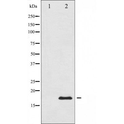 AF3359 staining HeLa cells by ICC/IF. Cells were fixed with PFA and permeabilized in 0.1% saponin prior to blocking in 10% serum for 45 minutes at 37¡ãC. The primary antibody was diluted 1/400 and incubated with the sample for 1 hour at 37¡ãC. A  Alexa Fluor 594 conjugated goat polyclonal to rabbit IgG (H+L), diluted 1/600 was used as secondary antibod