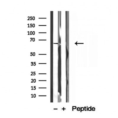 DF12121 staining HepG2 by IF/ICC. The sample were fixed with PFA and permeabilized in 0.1% Triton X-100,then blocked in 10% serum for 45 minutes at 25¡ãC. The primary antibody was diluted at 1/200 and incubated with the sample for 1 hour at 37¡ãC. An  Alexa Fluor 594 conjugated goat anti-rabbit IgG (H+L) Ab, diluted at 1/600, was used as the secondary antibod
