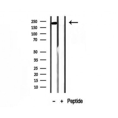 DF12122 staining HepG2 by IF/ICC. The sample were fixed with PFA and permeabilized in 0.1% Triton X-100,then blocked in 10% serum for 45 minutes at 25¡ãC. The primary antibody was diluted at 1/200 and incubated with the sample for 1 hour at 37¡ãC. An  Alexa Fluor 594 conjugated goat anti-rabbit IgG (H+L) Ab, diluted at 1/600, was used as the secondary antibod