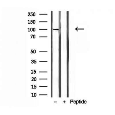 DF12125 staining HepG2 by IF/ICC. The sample were fixed with PFA and permeabilized in 0.1% Triton X-100,then blocked in 10% serum for 45 minutes at 25¡ãC. The primary antibody was diluted at 1/200 and incubated with the sample for 1 hour at 37¡ãC. An  Alexa Fluor 594 conjugated goat anti-rabbit IgG (H+L) Ab, diluted at 1/600, was used as the secondary antibod
