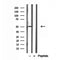 DF12126 at 1/100 staining Human breast cancer tissue by IHC-P. The sample was formaldehyde fixed and a heat mediated antigen retrieval step in citrate buffer was performed. The sample was then blocked and incubated with the antibody for 1.5 hours at 22¡ãC. An HRP conjugated goat anti-rabbit antibody was used as the secondary