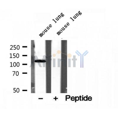 DF12127 at 1/100 staining Rat liver tissue by IHC-P. The sample was formaldehyde fixed and a heat mediated antigen retrieval step in citrate buffer was performed. The sample was then blocked and incubated with the antibody for 1.5 hours at 22¡ãC. An HRP conjugated goat anti-rabbit antibody was used as the secondary